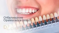 Отбеливание Оpalescence boost #отбеливаниезубов