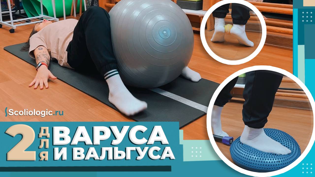 Эти упражнения помогут исправить варус/вальгус у детей!