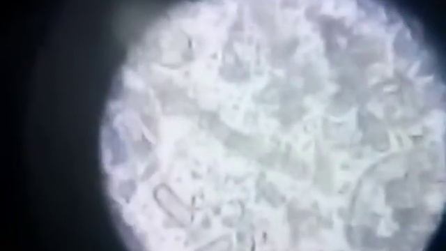 Cyanobacteria microscope 600 times