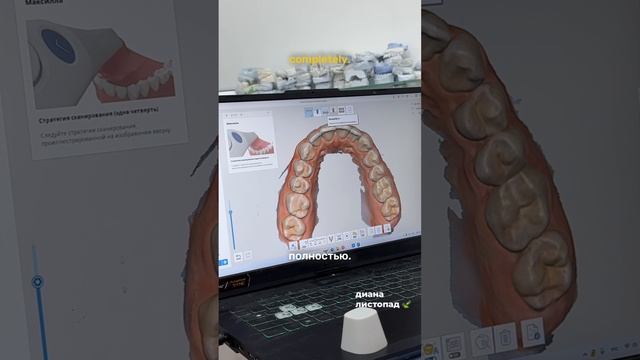 Ставлю элайнеры🦷

#рекомендации #реки #обзор #брекеты #элайнеры #стоматология #деньги #здоровье