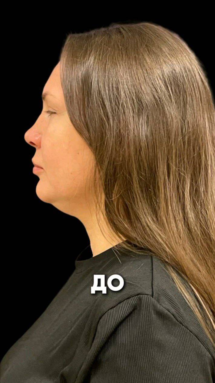 📌 ЛИПОЛИТИКИ: ДА ИЛИ НЕТ?