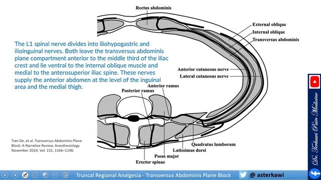 Transversus Abdominis Plane (TAP) Block