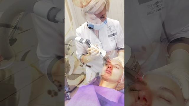 Лазерная шлифовка Fraxel | Шумейко Г.Д.
