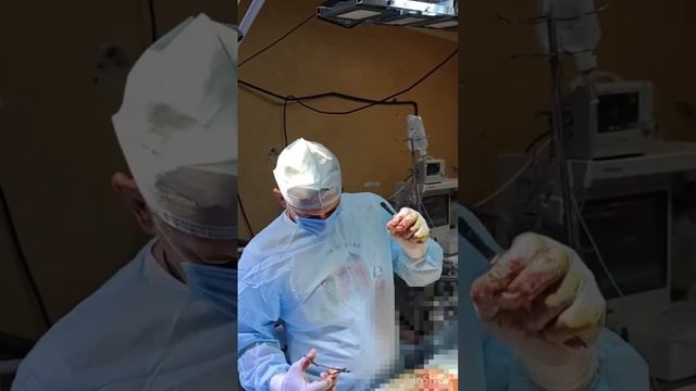 Апти Алаудинов "АХМАТ". Оперирование бойца со сложным ранением