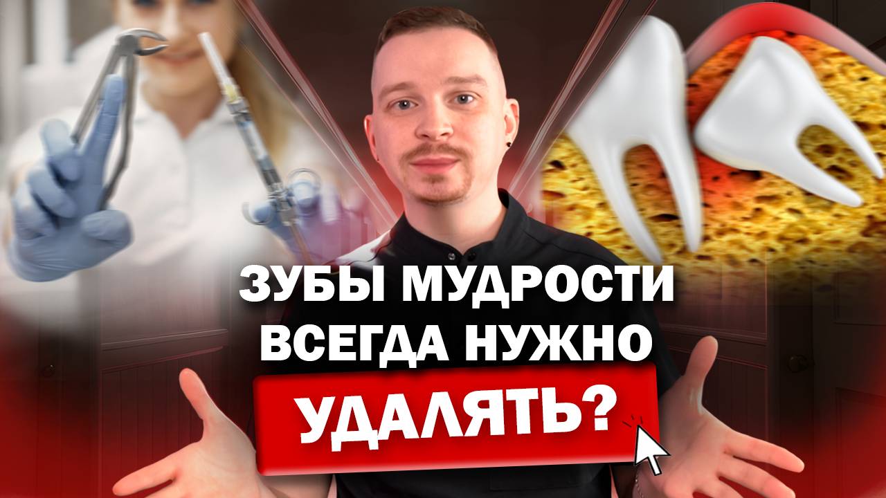 ВСЕ о зубах мудрости. Всегда нужно удалять зубы мудрости Зубы мудрости удаление