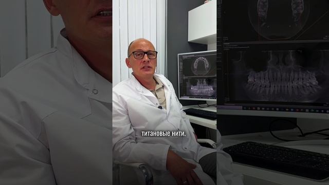 Ретейнеры после ортодонтического лечения.