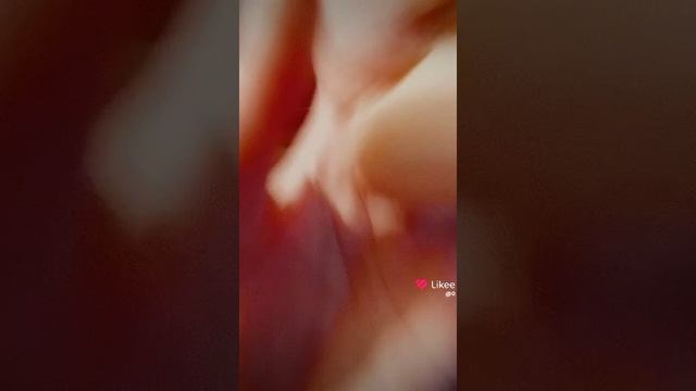 1000000263.mp4