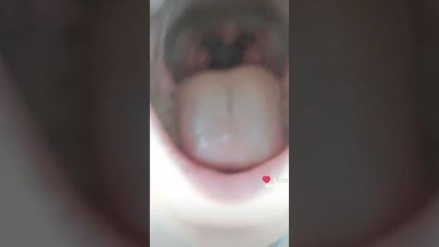 1000026718.mp4