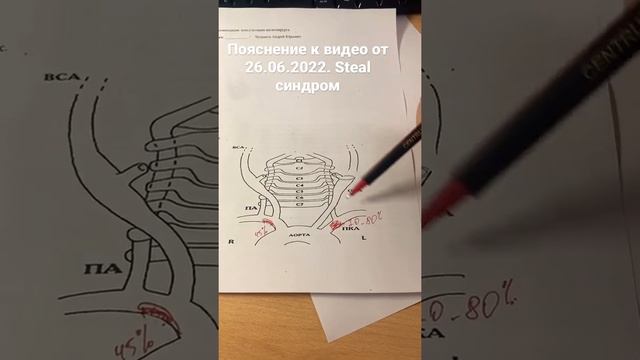 Пояснение к видео от 26.06.2022. Steal синдром.