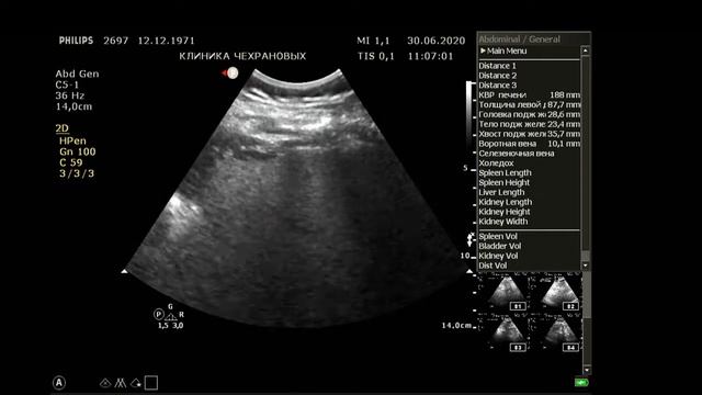 УЗИ органов брюшной полости 2020 06 30 10 57 50