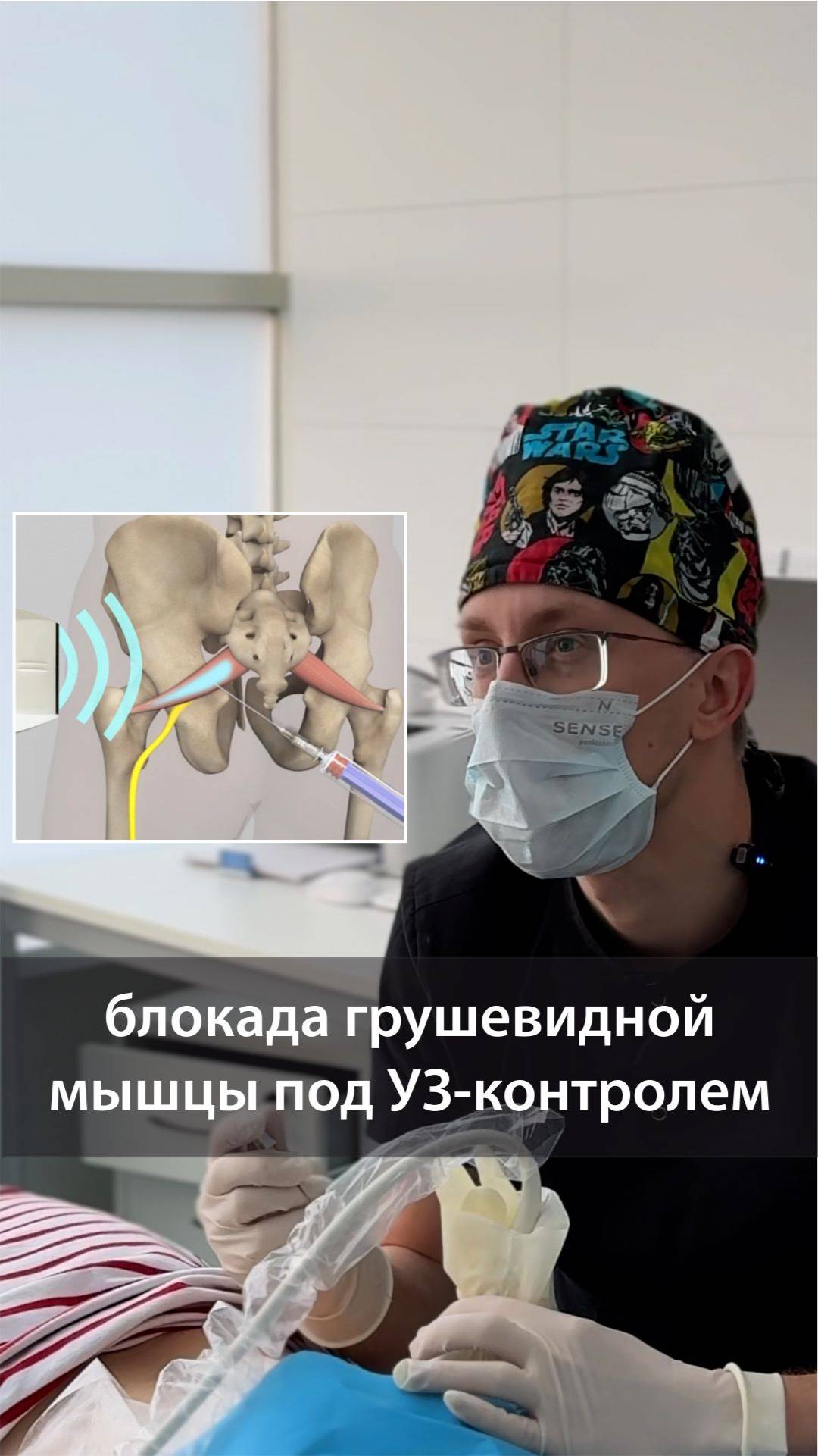 Блокада грушевидной мышцы с ультразвуковой навигацией