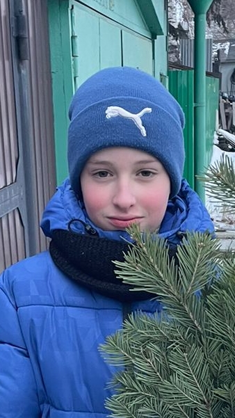 спалил лицо