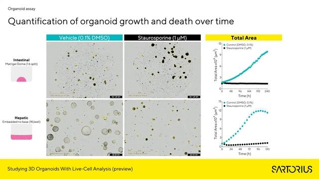 Incucyte Webinar (Preview): Studying 3D Organoids with Live-Cell Analysis