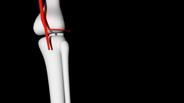 Артерии Нижней Конечности (СХЕМАТИЧНО) | Medanatfarm