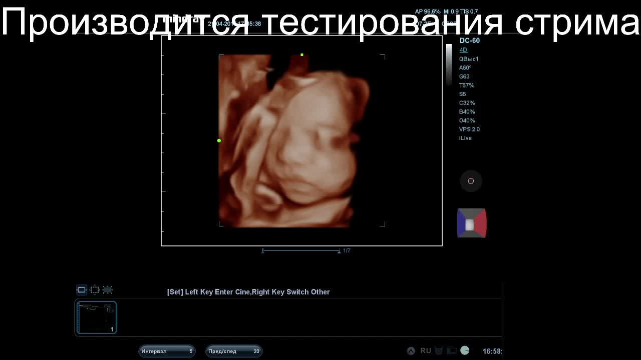 тест
