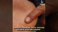 Пиранья покусала рыбака на канале Нура – Есиль в Астане