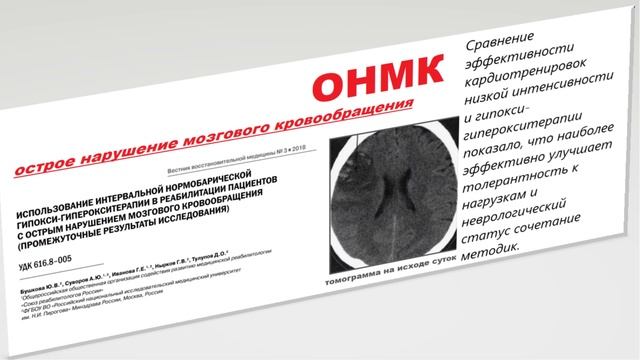 ОНМК-острое нарушение кровообращения мозга