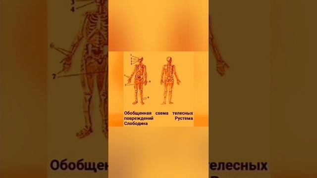 Научное объяснение травм Рустема Слободина 3