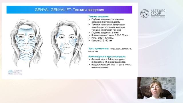 WEBINAR ASTEURO GROUP  Биореструктуризация препаратами Genyalift, Doublyx Evo, Peptidyal HX