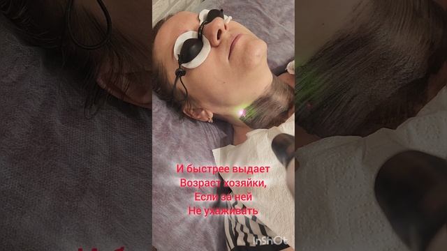Карбоновый пилинг шеи