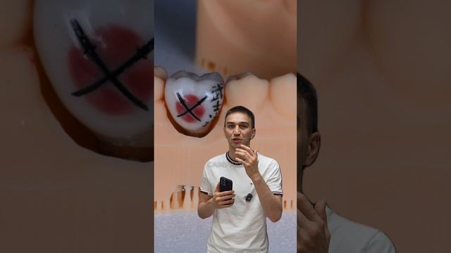 Тату на зубе