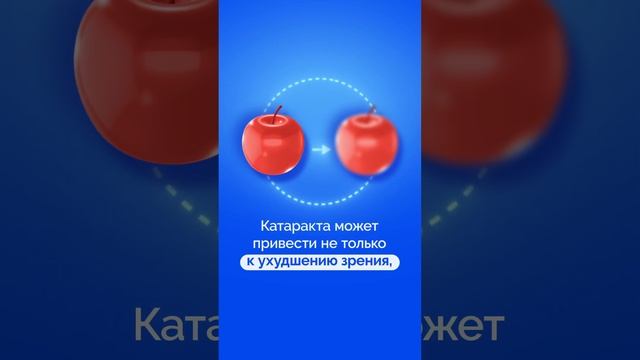 Курение и катаракта #shorts #катаракта