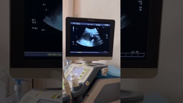 Жемчуговы 🥰❤️🔥