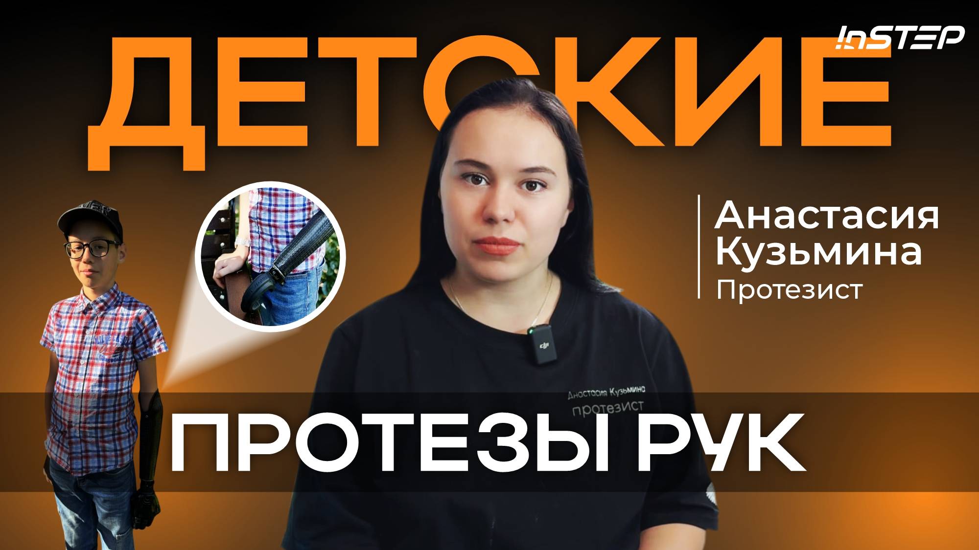 Все нюансы протезирования верхних конечностей у детей | Instep