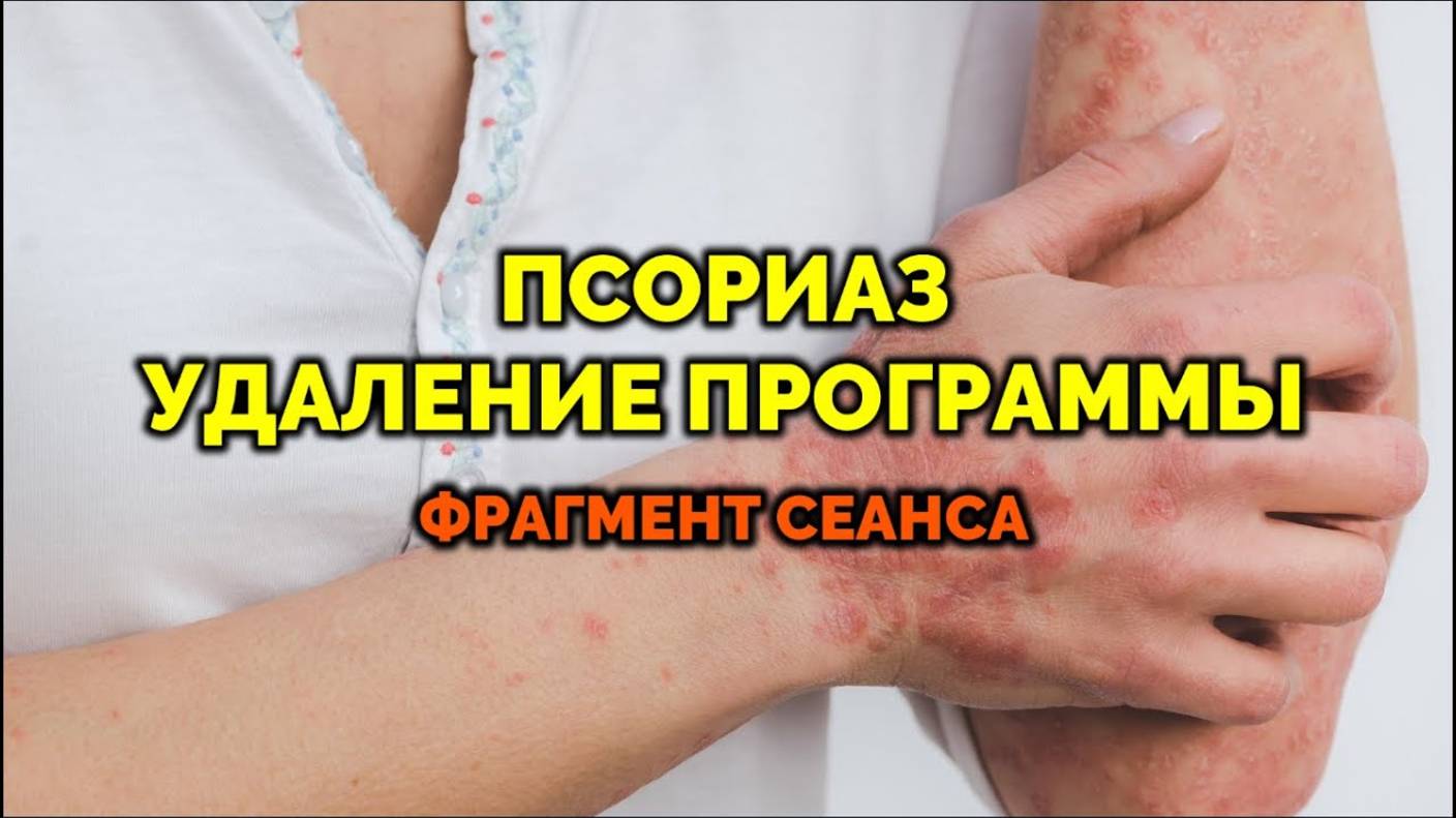 ПСОРИАЗ: УДАЛЕНИЕ ПРОГРАММЫ. СЕАНС ЭНЕРГОЧИСТКИ