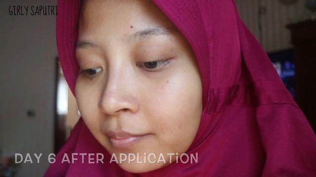 COSRX Two In One Poreless Power Liquid - 2WEEKS TRIAL