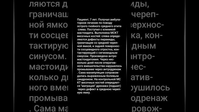 МСКТ височных костей. Деструкция сосцевидного отростка и пирамиды височной кости слева.