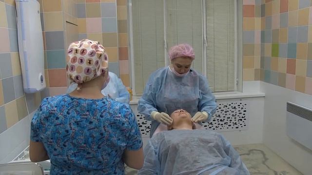 Лигатурная пластика. Нити Минт Лифт. Часть 2.