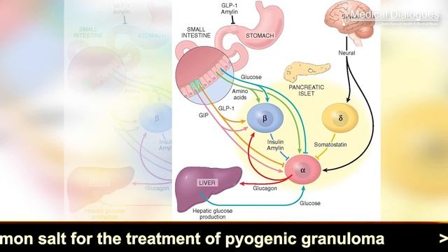 Hydrogels  Novel Technique For Glucose Delivery
