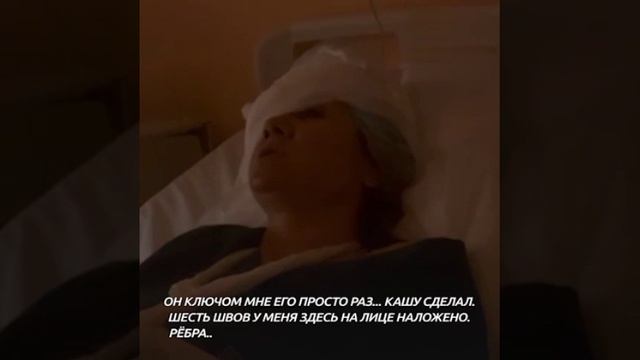 Сочинский абьюзер выколол глаз бывшей девушке ключом для зажигания, сломал руку и рёбра.