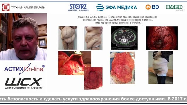 Самарцев "Периоперационная профилактика и прогнозирование осложнений в геронтологии"