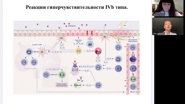 Новая классификация аллергических заболеваний