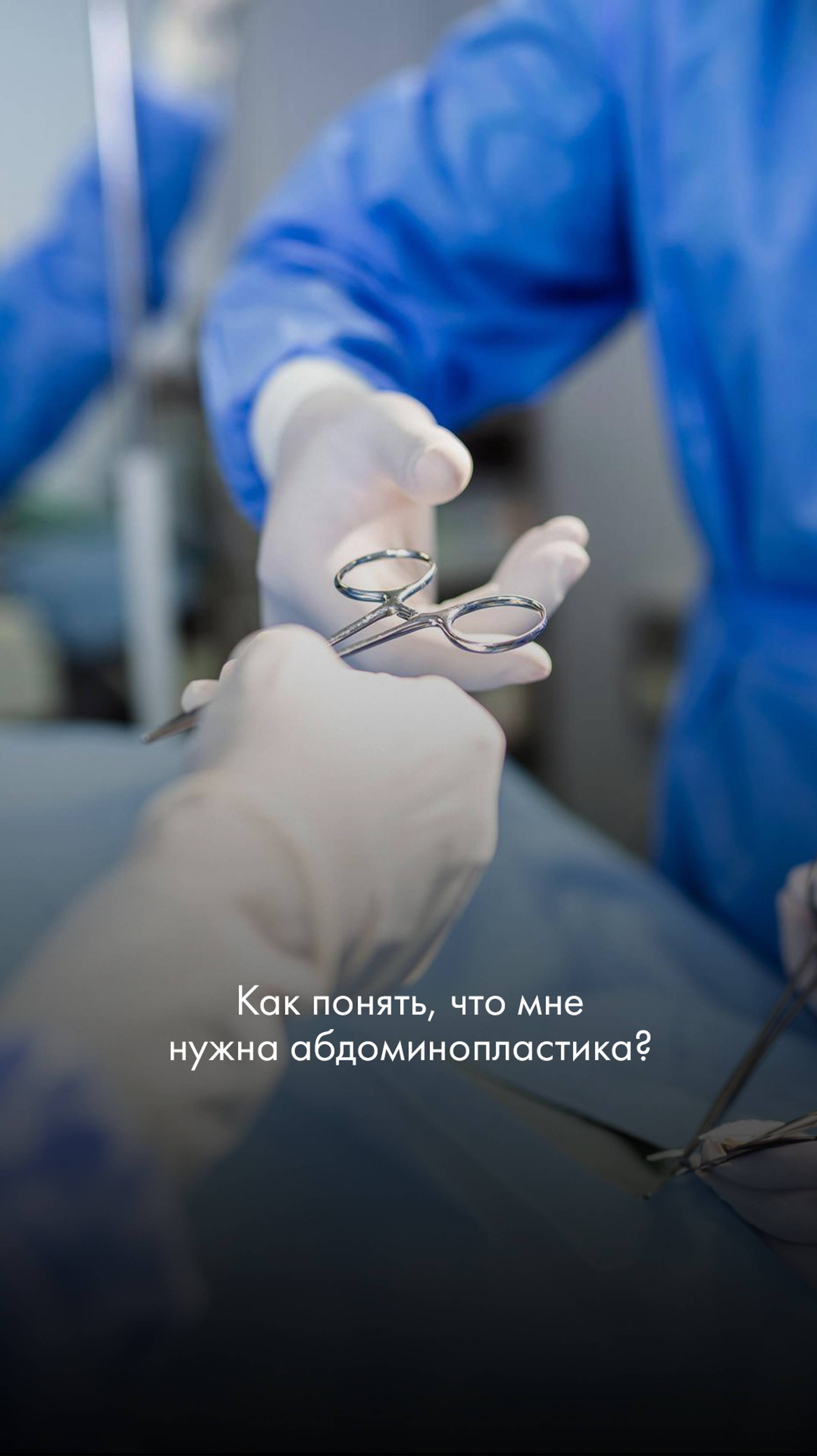 Как понять, что мне нужна абдоминопластика?