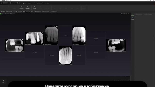 Сравнение нескольких 2D-изображений