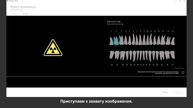 Автоповорот внутриротовых рентгеновских изображений