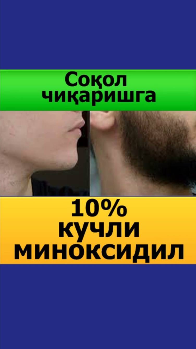 Соч сокол чикарувчи миноксидил