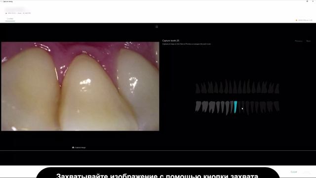 Получение изображений сделанных с помощью внутриротовых камер
