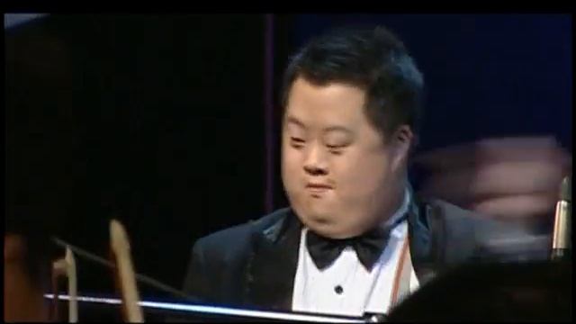 Down syndrome conductor