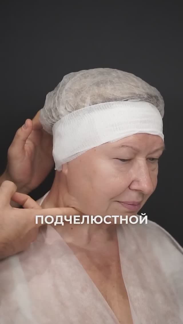 FaceTite. Этап 2