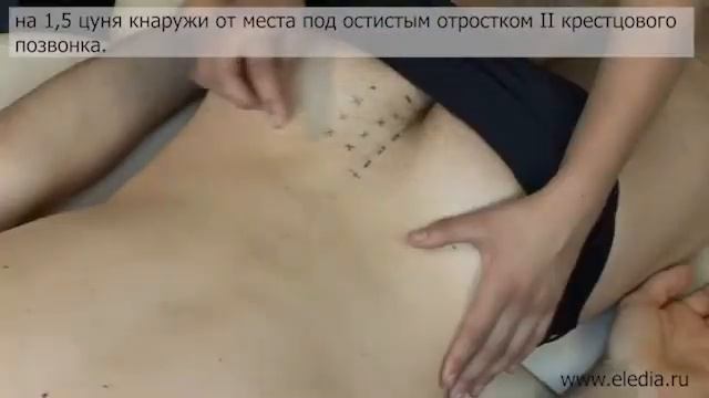 Цистит