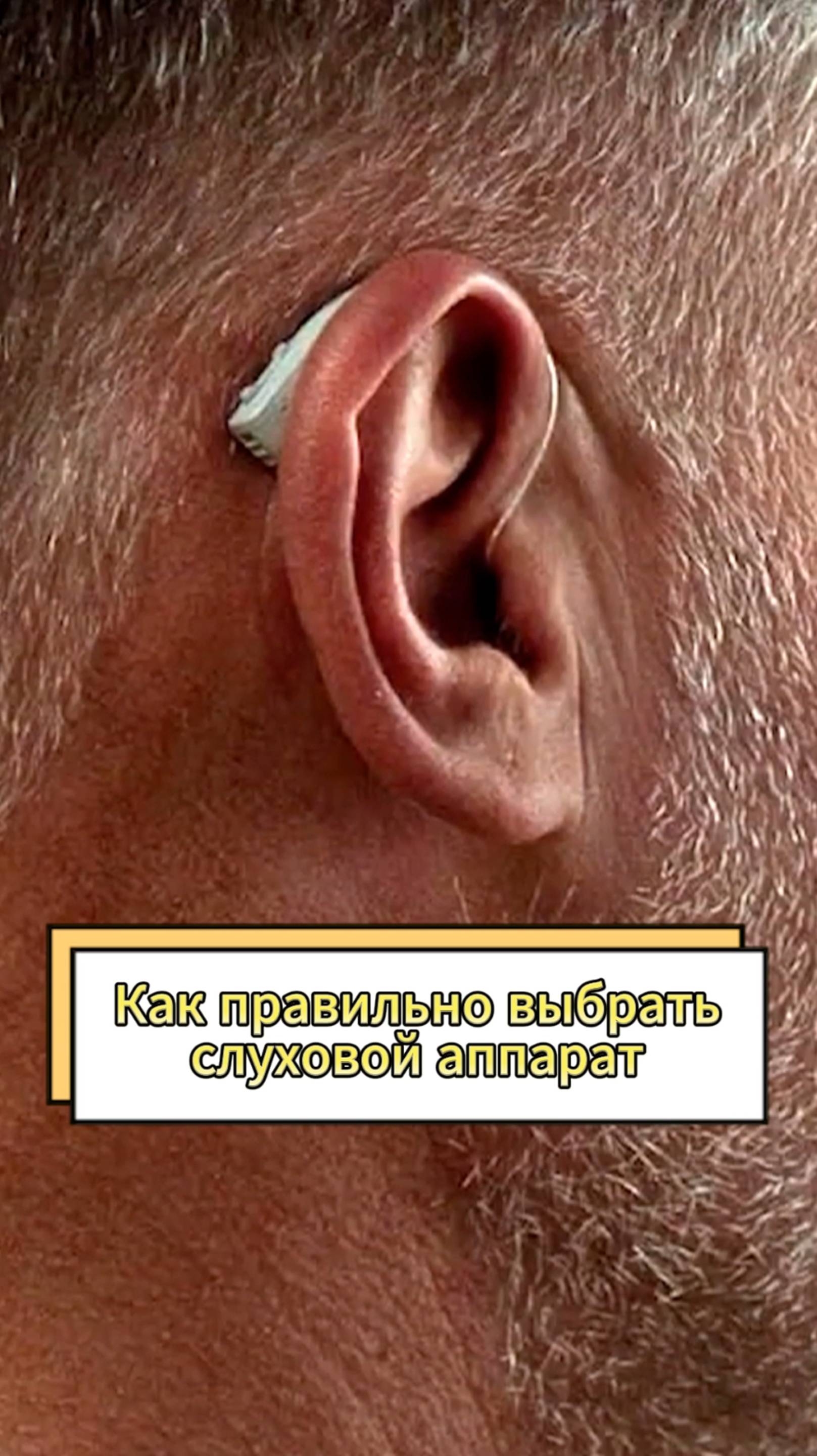 Как правильно выбрать слуховой аппарат?