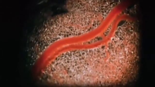 Институт Умной воды (SWI) ПРЕДУПРЕЖДАЕТ: ионизированная вода - снижает опасность инсульта