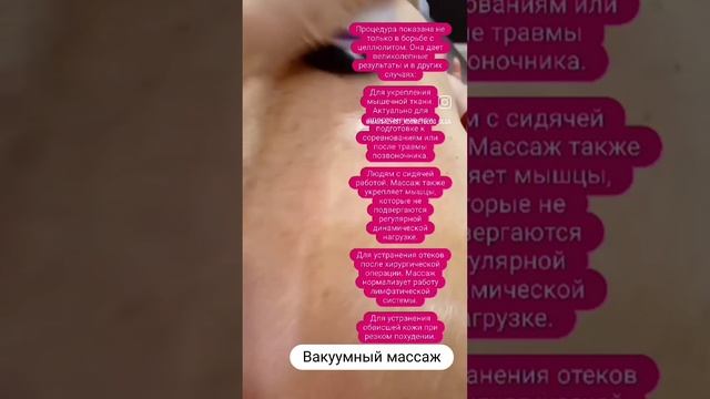 вакуумно ролликовый массаж