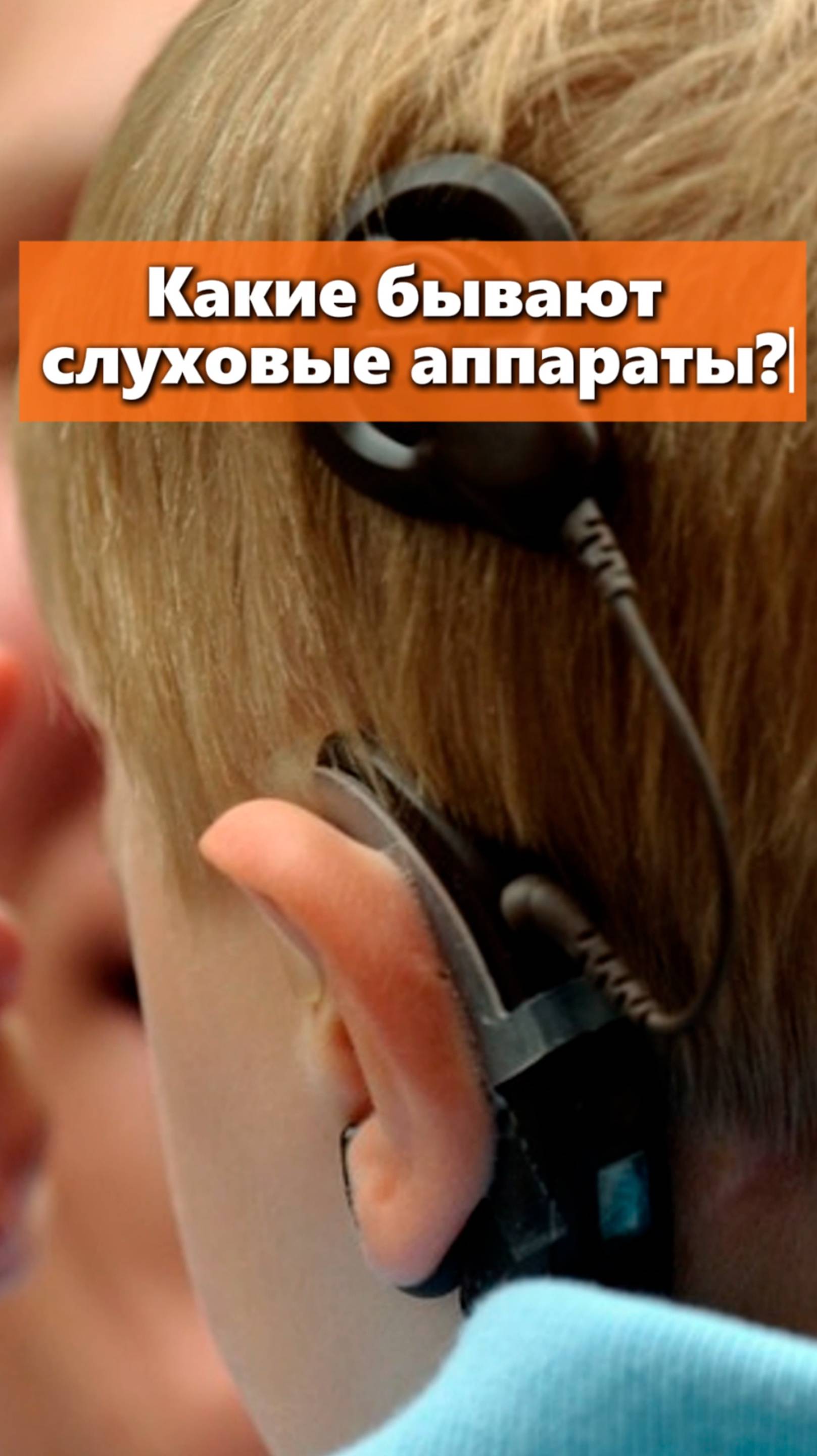Слуховые аппараты виды и цены.