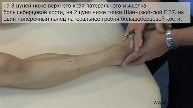 Паралич нижних конечностей
