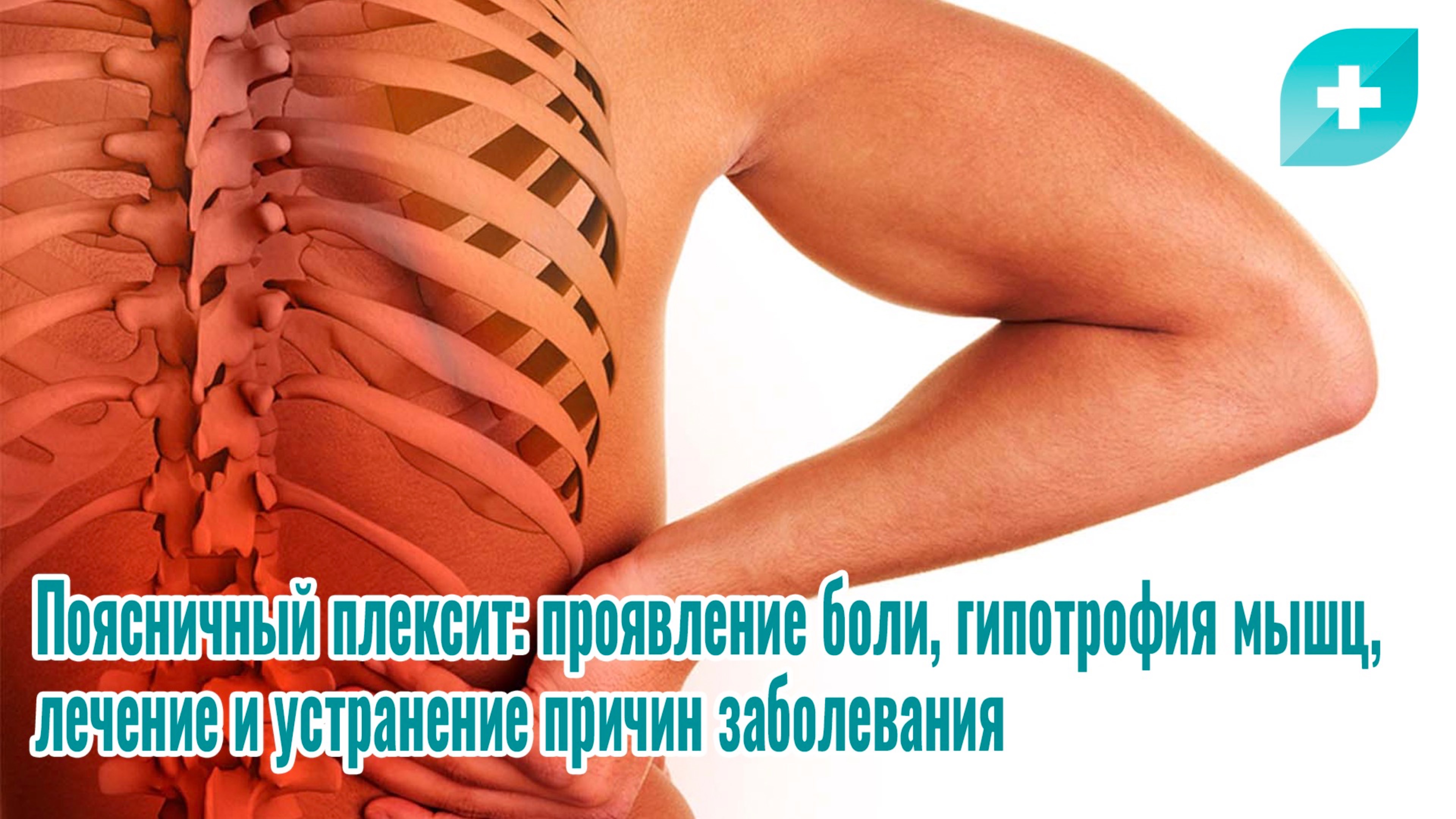 Поясничный плексит: проявление боли, гипотрофия мышц, лечение и устранение причин заболевания